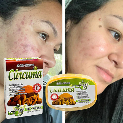 JABON DE CURCUMA